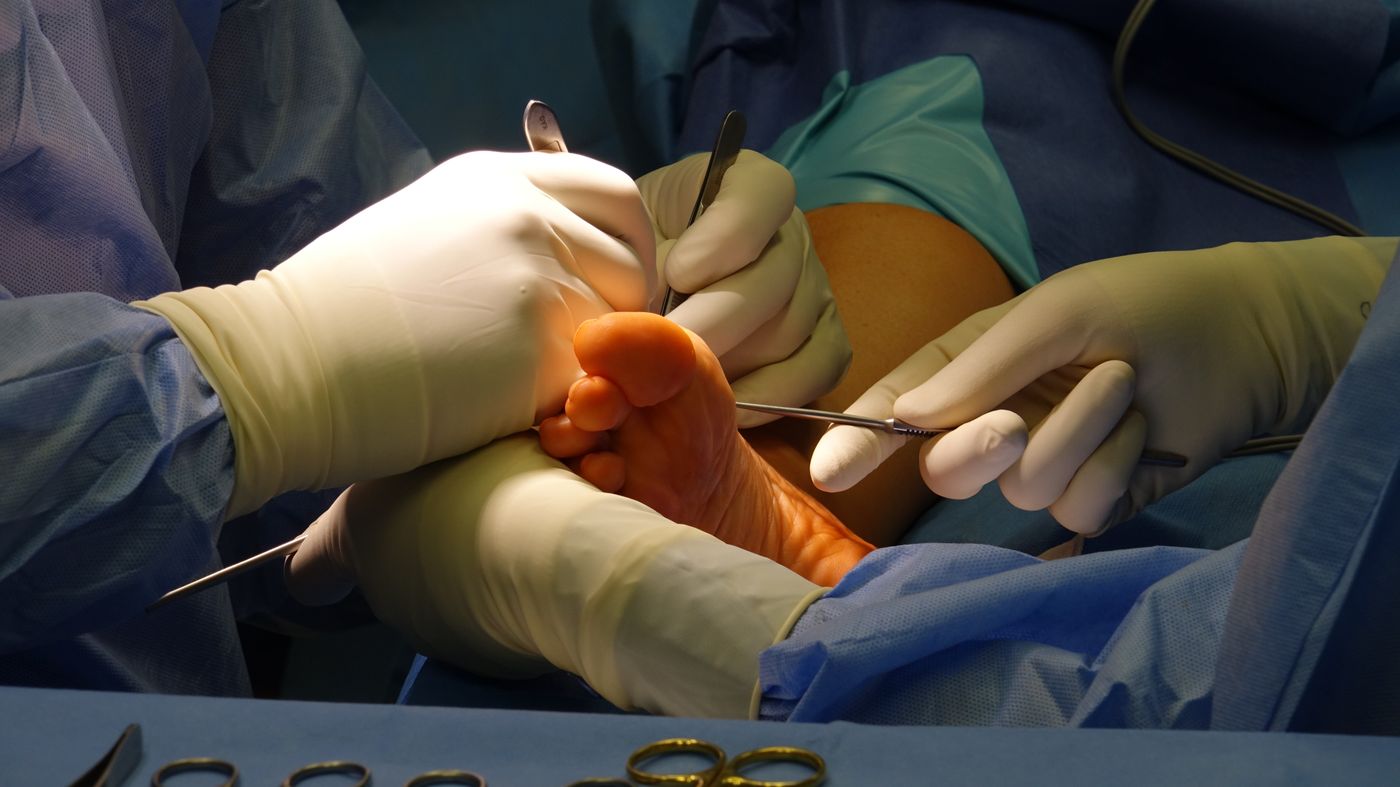 Surgical team performing an outpatient procedure on a patient’s foot